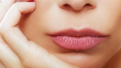 7 Remedies for Chapped, Dry Lips