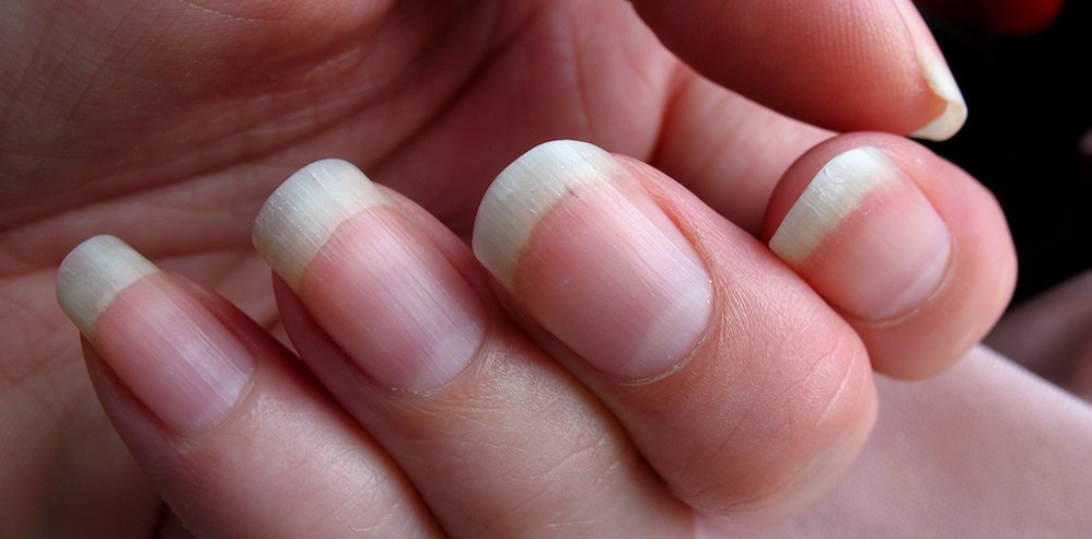 10 Nail Features And What They Say About Your Health